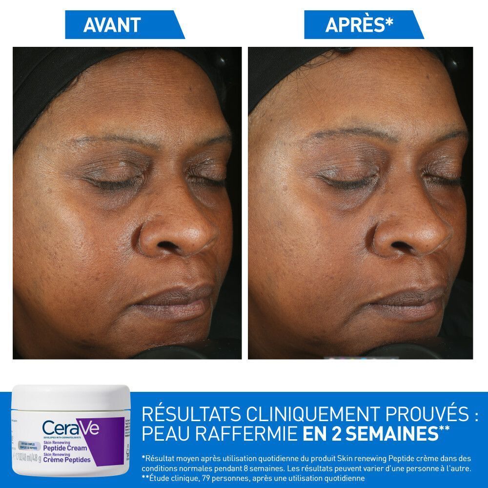 Images visage avant-après. CeraVe Skin Renewing Crème Peptides. Texte.
