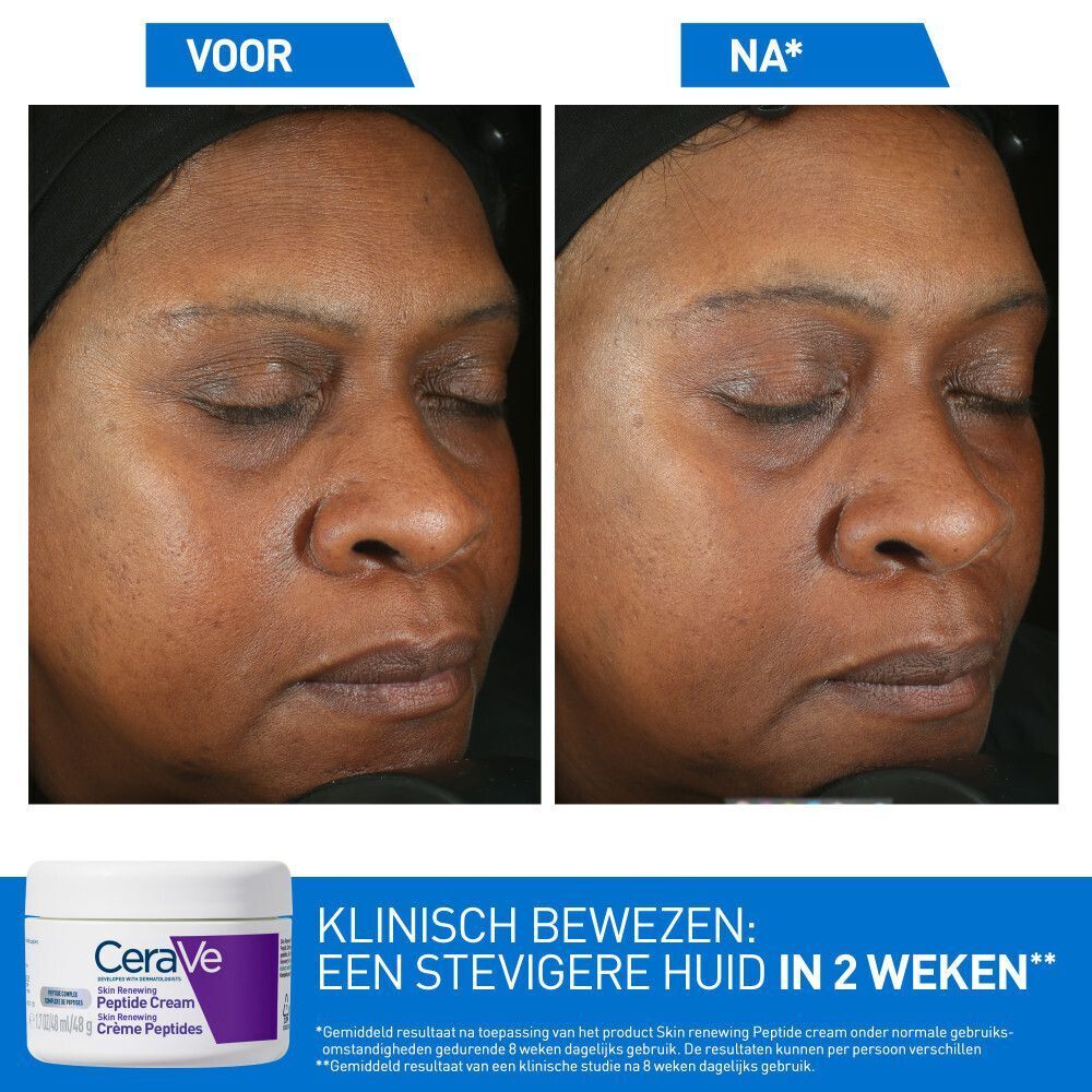 Voor- en na-gezichtsbeelden. CeraVe Skin Renewing Crème Peptides. Tekst.