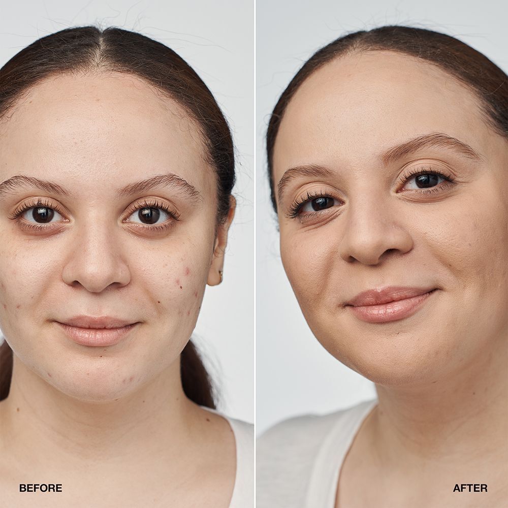 Vorher-Nachher-Vergleich einer Frau, die Clinique Even Better Clinical Serum Foundation SPF 20 trägt.