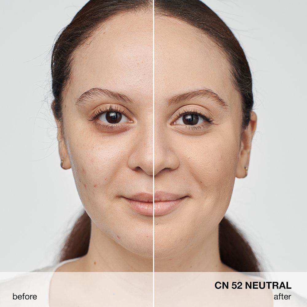 Vorher/Nachher-Vergleich von CLINIQUE Anti-Blemish Solutions Liquid Makeup CN 52 Neutral.