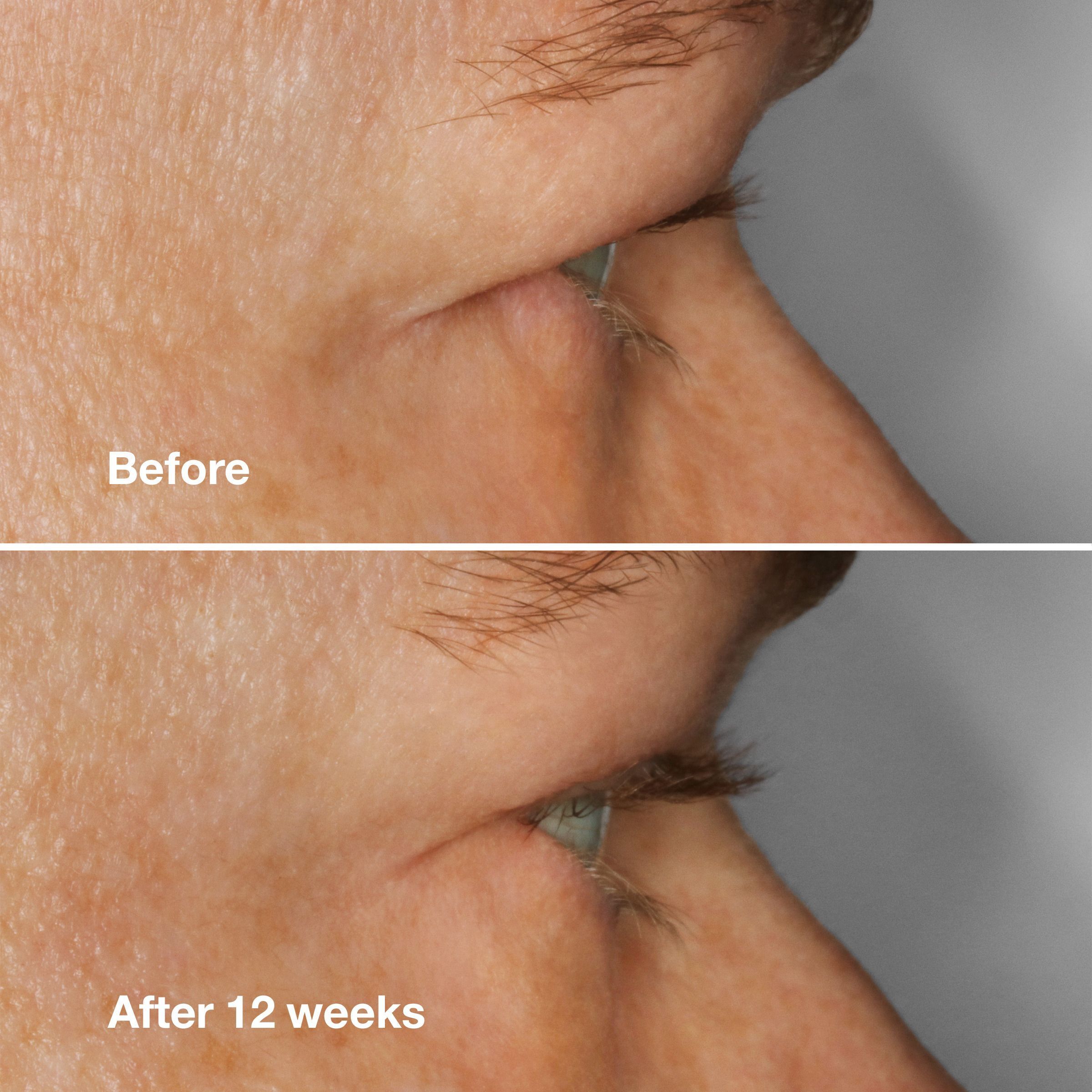 CLINIQUE High Impact Lash Serum