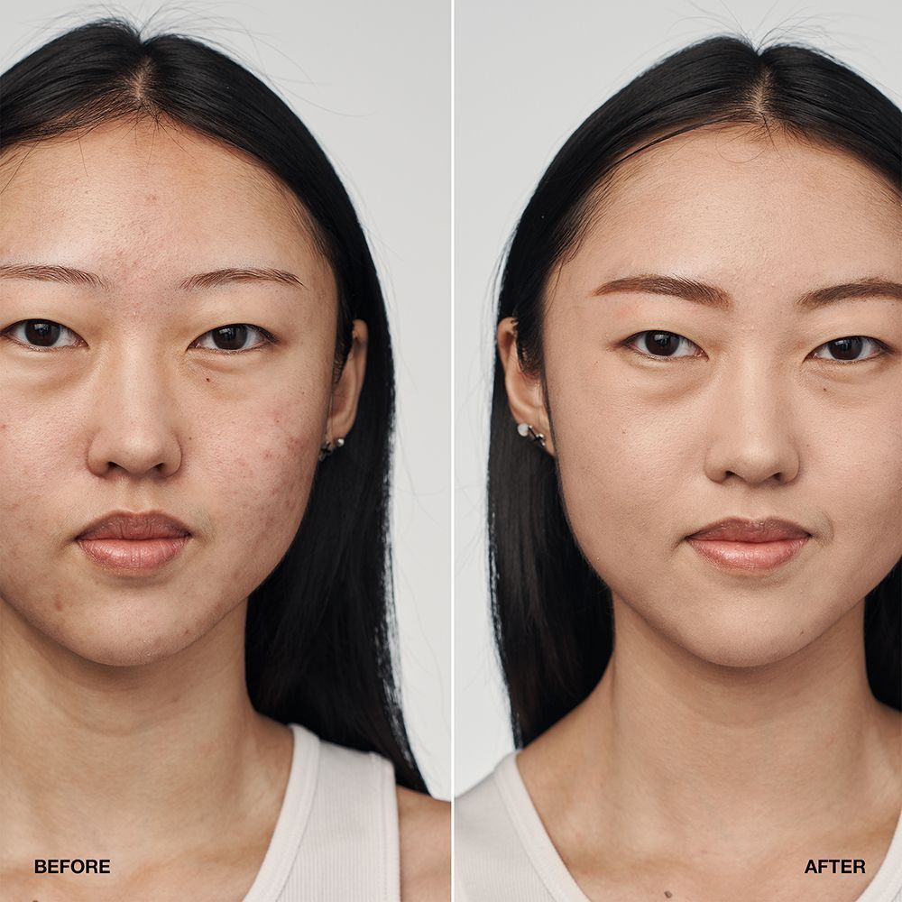 Vorher-Nachher-Vergleich einer Frau, die CLINIQUE Even Better Clinical Serum Foundation LSF 20 trägt.