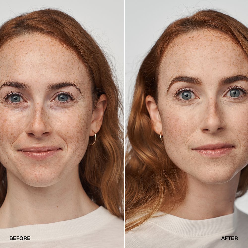 Vorher-Nachher-Vergleich einer Frau, die CLINIQUE Even Better Clinical Serum Foundation LSF 20 trägt.