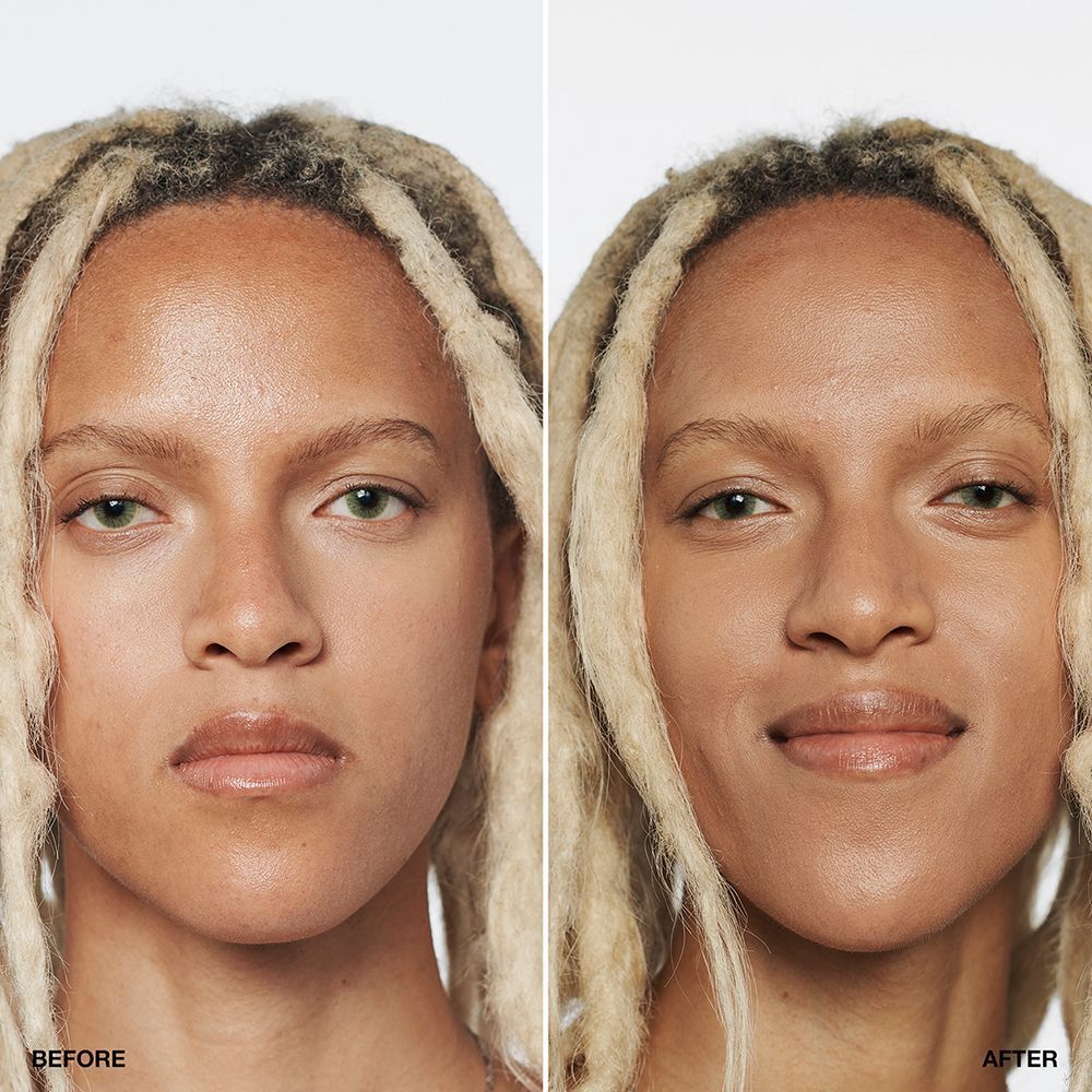 Vorher-Nachher-Vergleich einer Person, die CLINIQUE Anti-Blemish Solutions Liquid Makeup in Beige trägt.