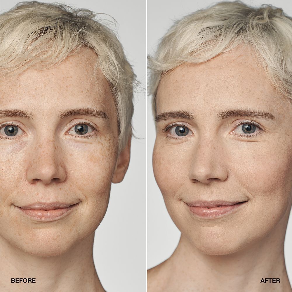 Vorher-Nachher-Vergleich einer Frau mit CLINIQUE Even Better Clinical Serum Foundation SPF 20.