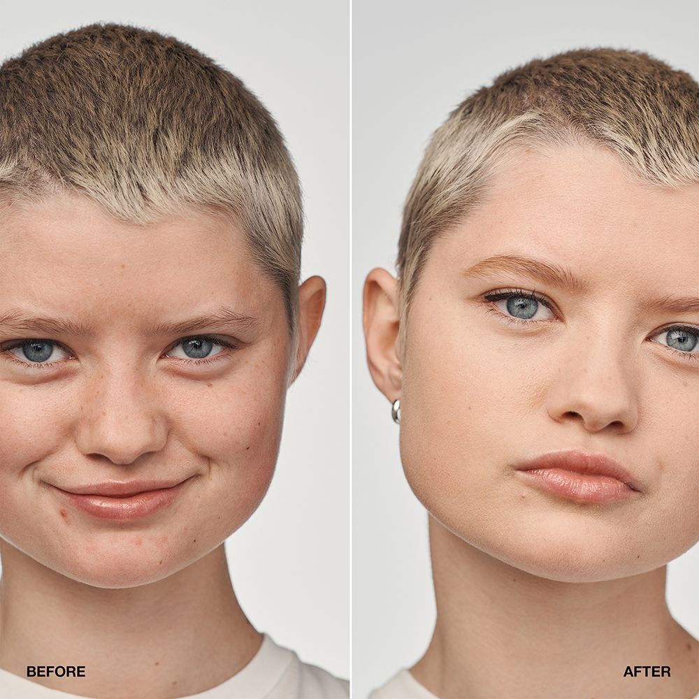 Vorher-Nachher-Vergleich einer Person mit CLINIQUE Even Better Clinical™ Serum Foundation SPF 20.