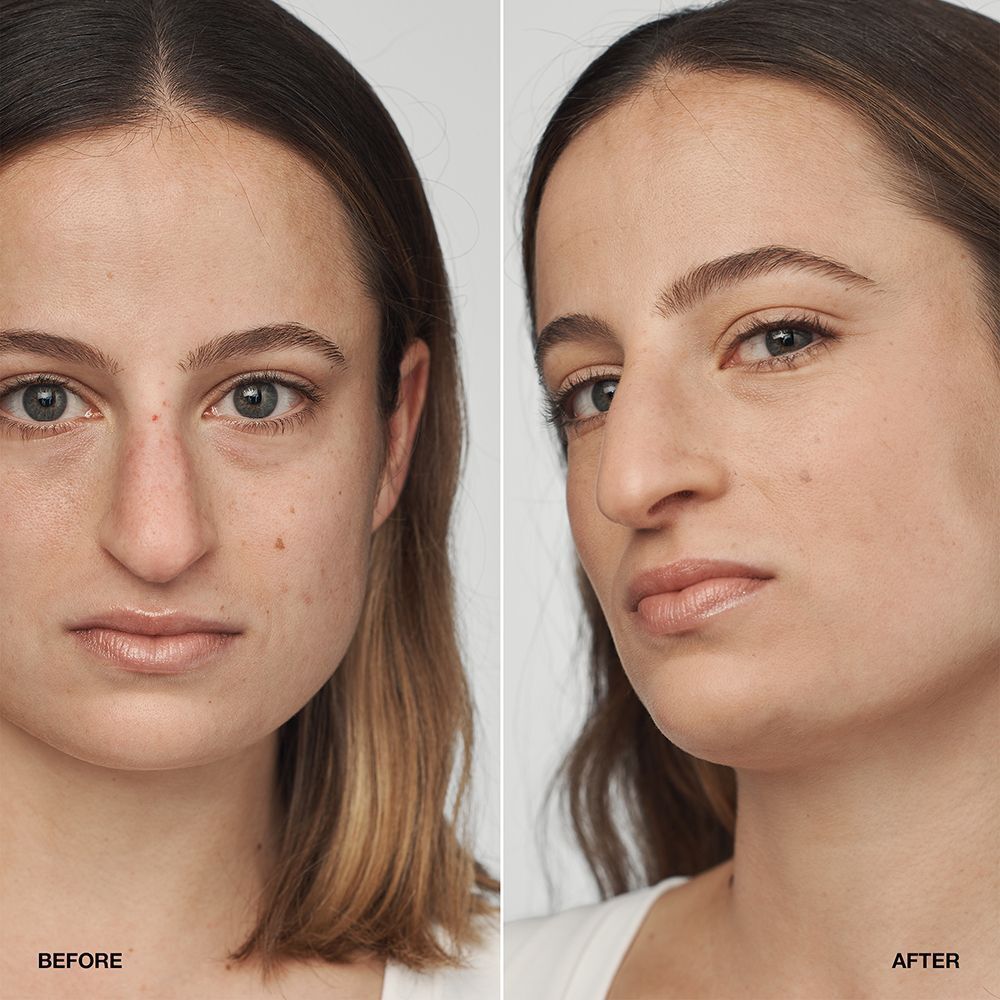 Vorher-Nachher-Vergleich einer Frau, die CLINIQUE Even Better Clinical Serum Foundation trägt.