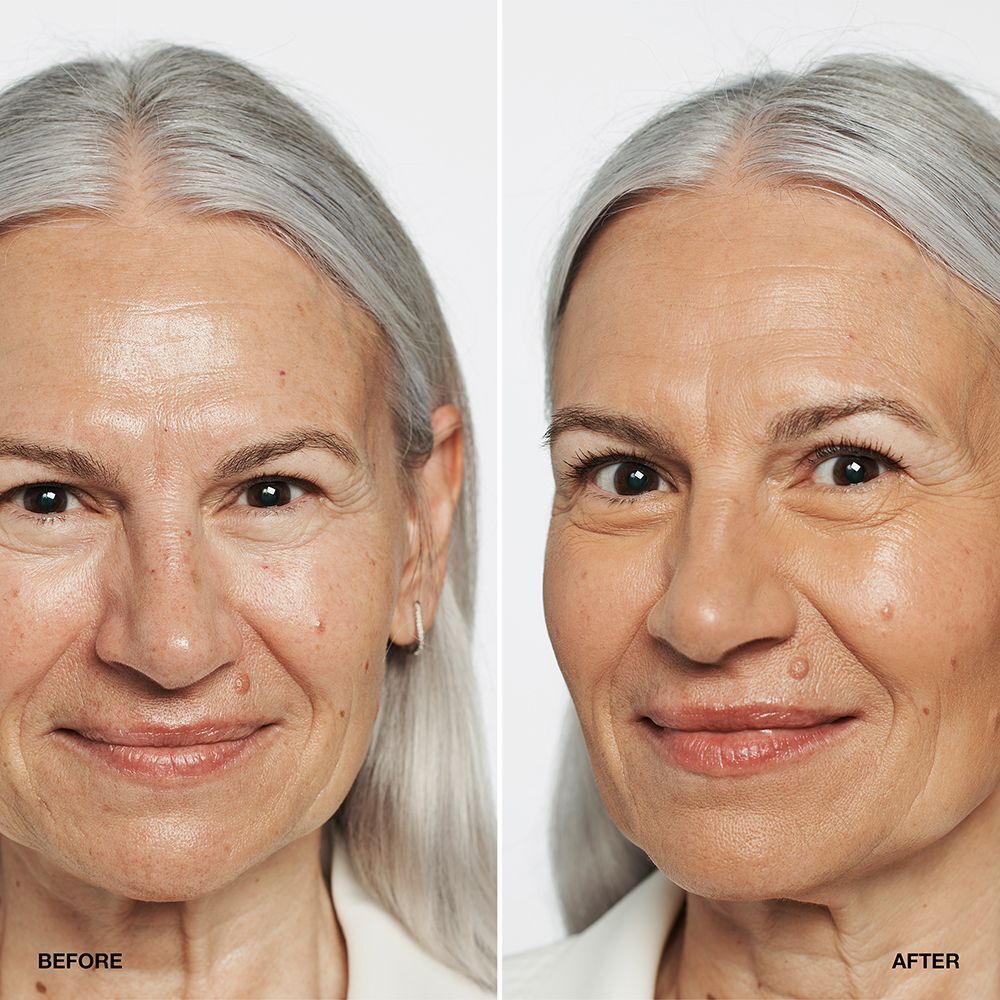 Vorher-Nachher-Vergleich einer Frau mit CLINIQUE Even Better Makeup SPF 15.