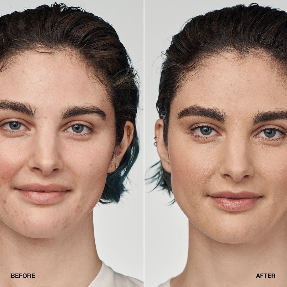 Vorher-Nachher-Vergleich einer Frau, die CLINIQUE Even Better Clinical Serum Foundation trägt.