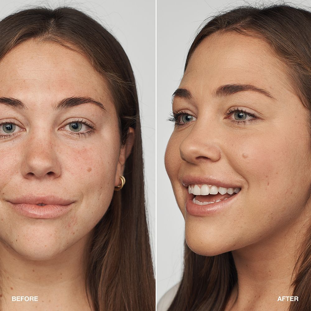 Vorher/Nachher-Vergleich einer Frau mit Clinique Even Better Clinical Serum Foundation.