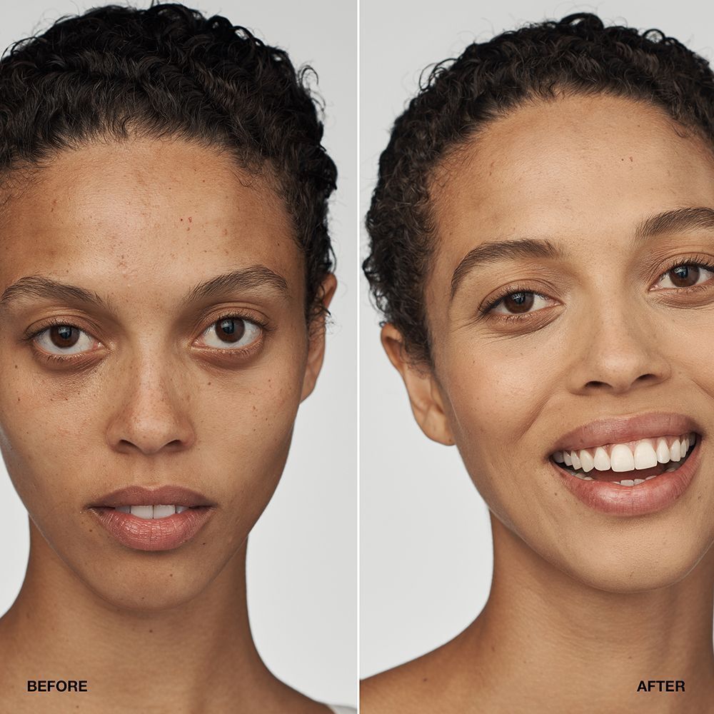 Vorher-Nachher-Vergleich einer Frau, die Clinique Even Better Clinical Serum Foundation trägt.