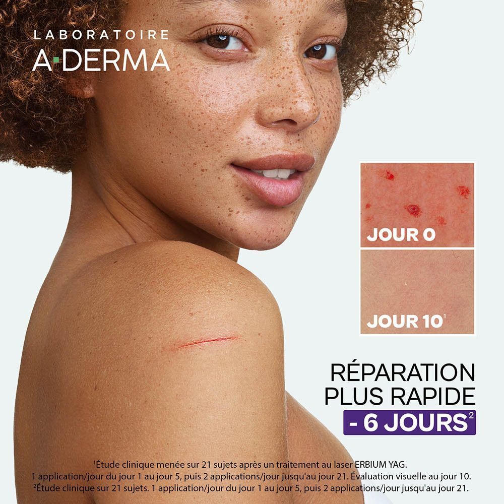 Femme avec irritations cutanées. Photos comparatives: Jour 0 et Jour 10. Texte: Réparation plus rapide - 6 jours.