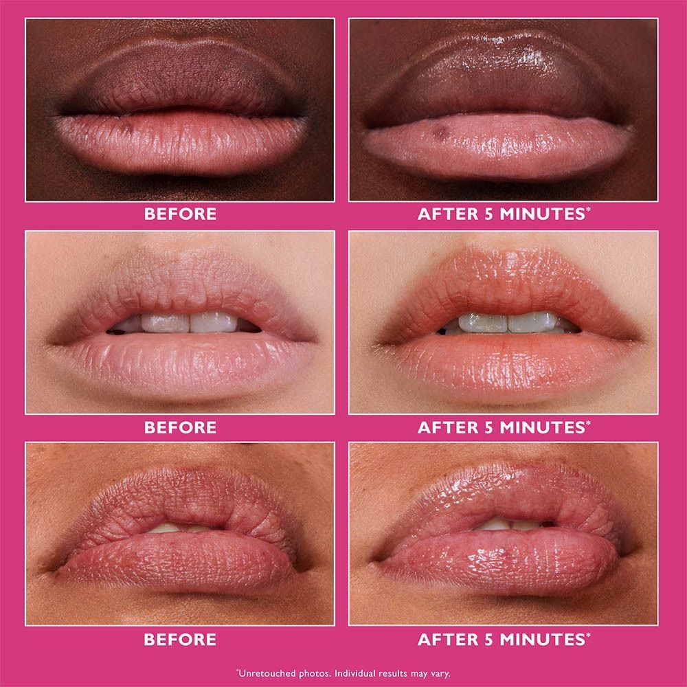 Meerdere voor-en-na vergelijkingen van lippen. Zes paren lippen getoond voor en na gebruik van het product.