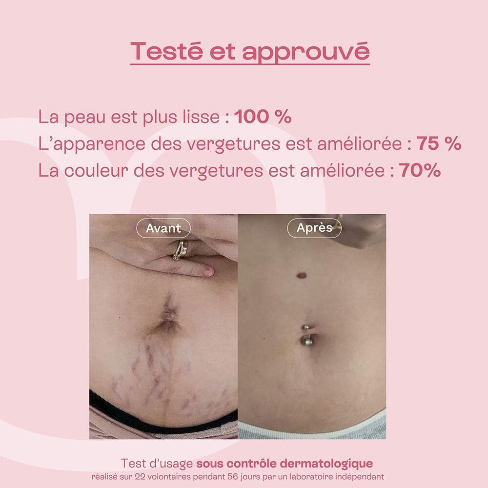 Omum l'Expert Concentré Correcteur contre les Vergetures Bio