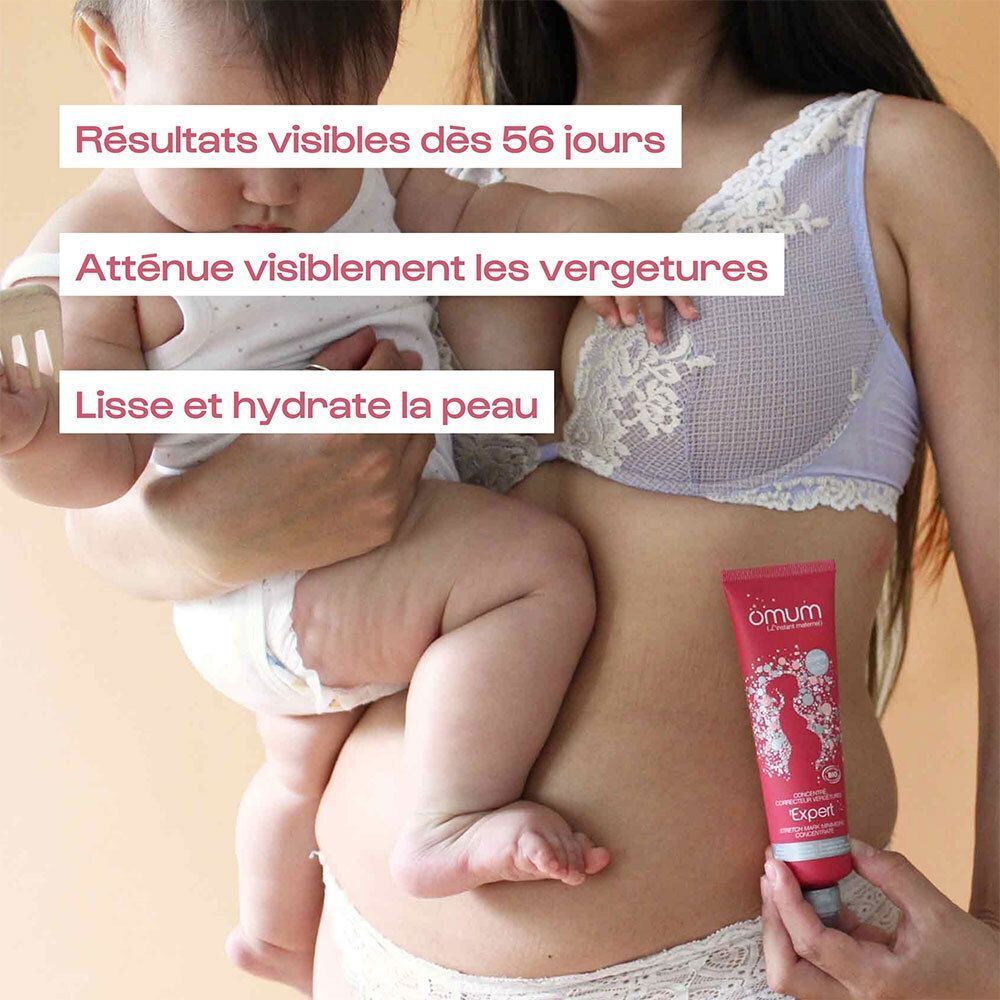 Omum l'Expert Concentré Correcteur contre les Vergetures Bio
