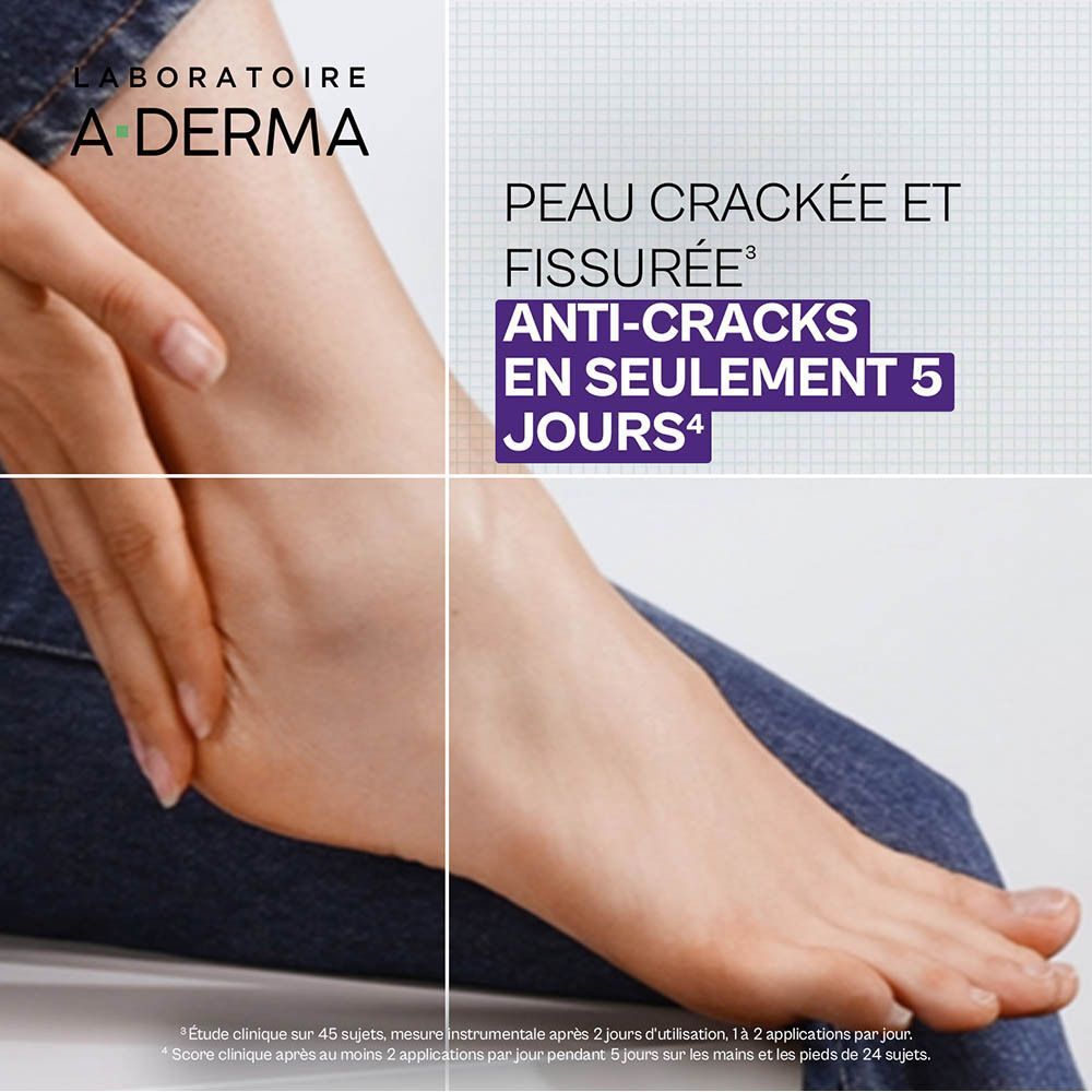 A-Derma Epitheliale Ultra Repair agit sur peau craquée et fissurée en 5 jours.