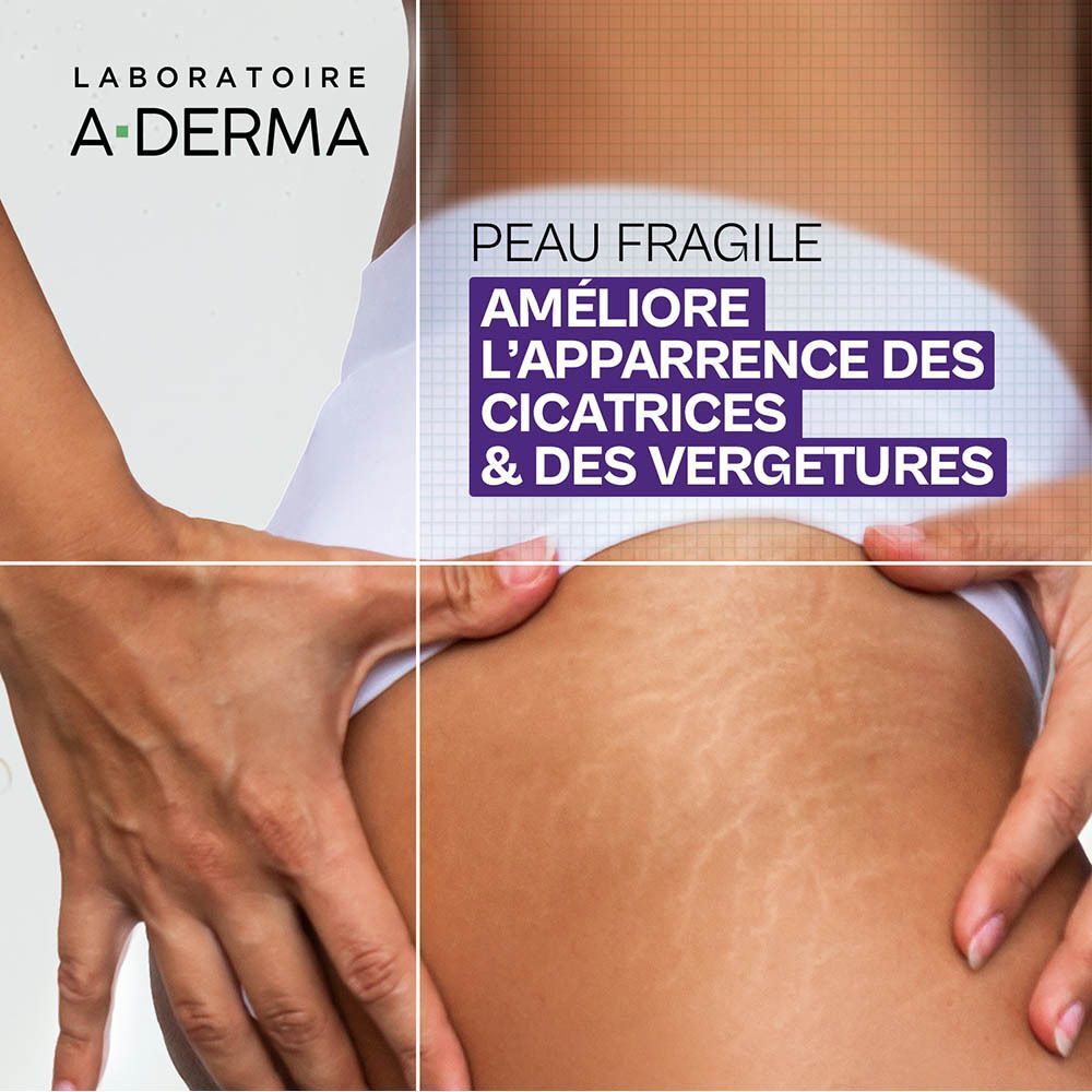 A-Derma Epitheliale Ultra Repair | Gel-Huile de Massage Anti-marques | cicatrices & vergetures