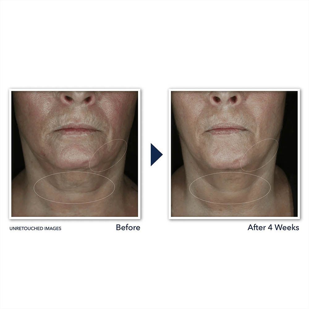 RoC Derm Correxion Crème Contour
