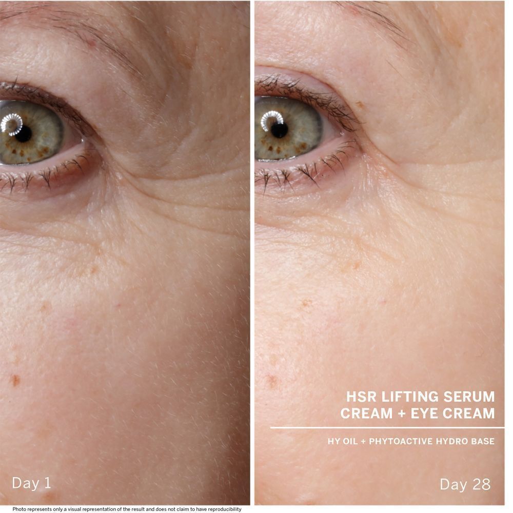 Vorher-Nachher-Vergleich der Haut um das Auge, Tag 1 und Tag 28, mit HSR Lifting Serum Cream + Eye Cream.