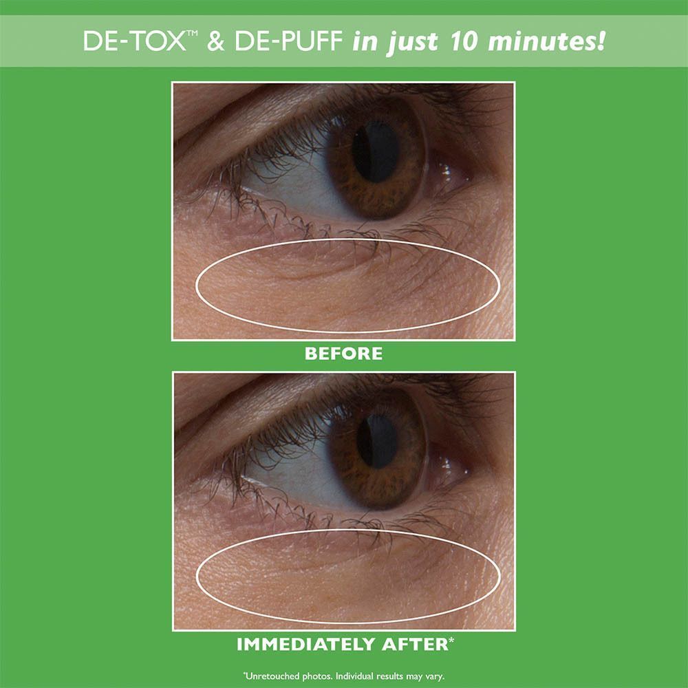 Comparaison avant-après de la zone des yeux montrant l'effet des patchs oculaires Peter Thomas Roth.