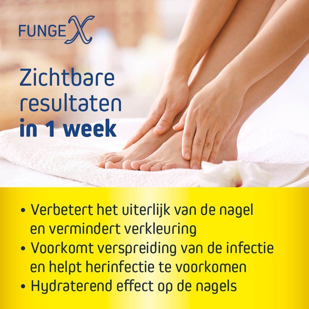 Vijf voordelen van Fungex Forte nagelschimmelpleisters, waaronder snelle resultaten en eenvoudige toepassing.