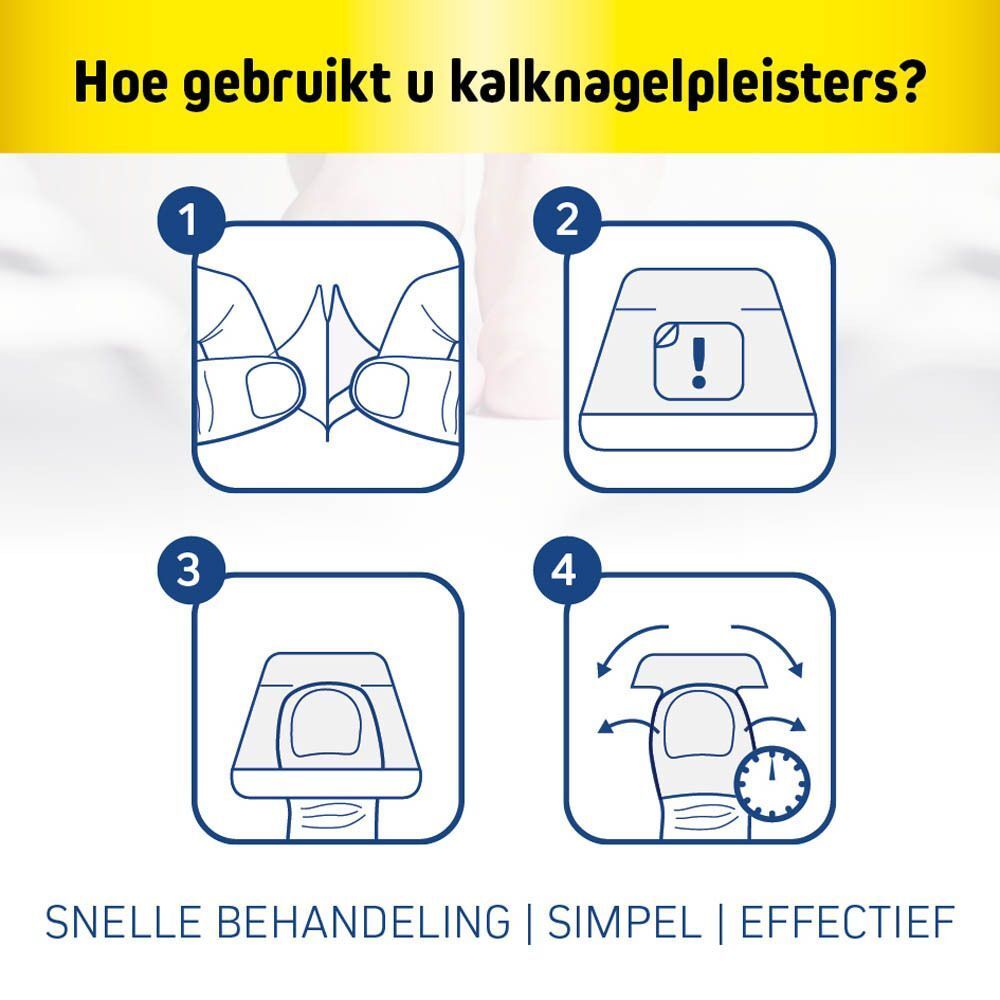 Drie verpakkingen Fungex-producten, waaronder nagelschimmelpleisters en een nagelverzorger.