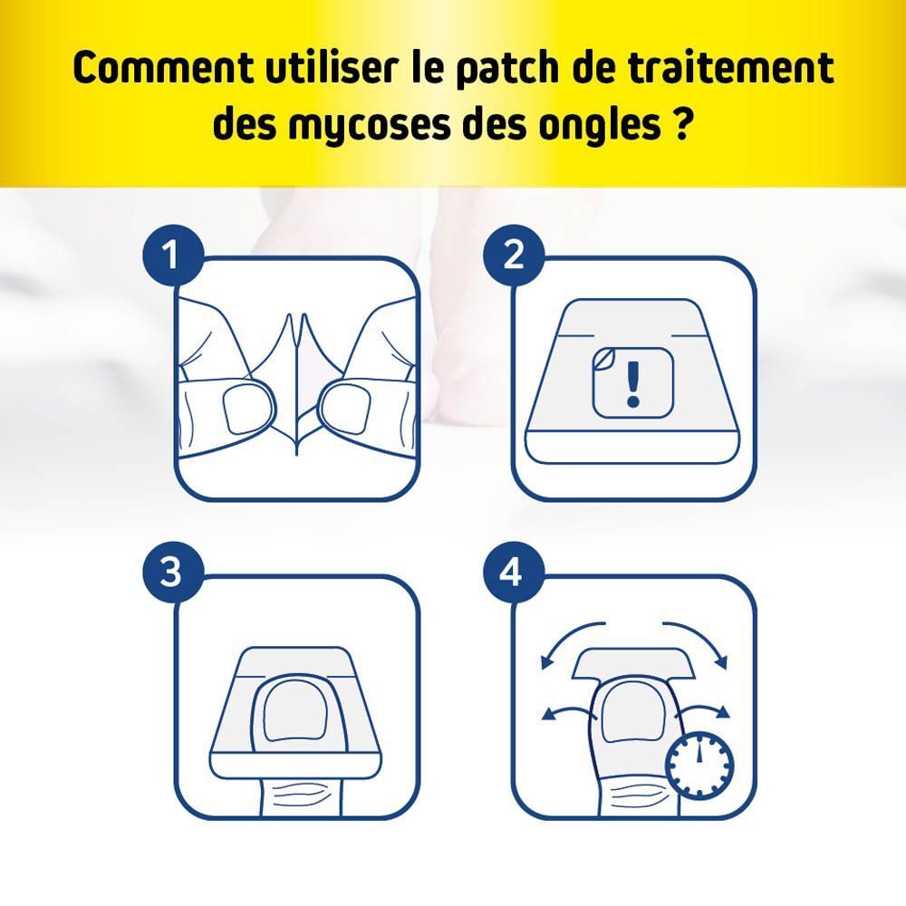 Instructions étape par étape pour l'application des patchs FungeX pour mycose des ongles.