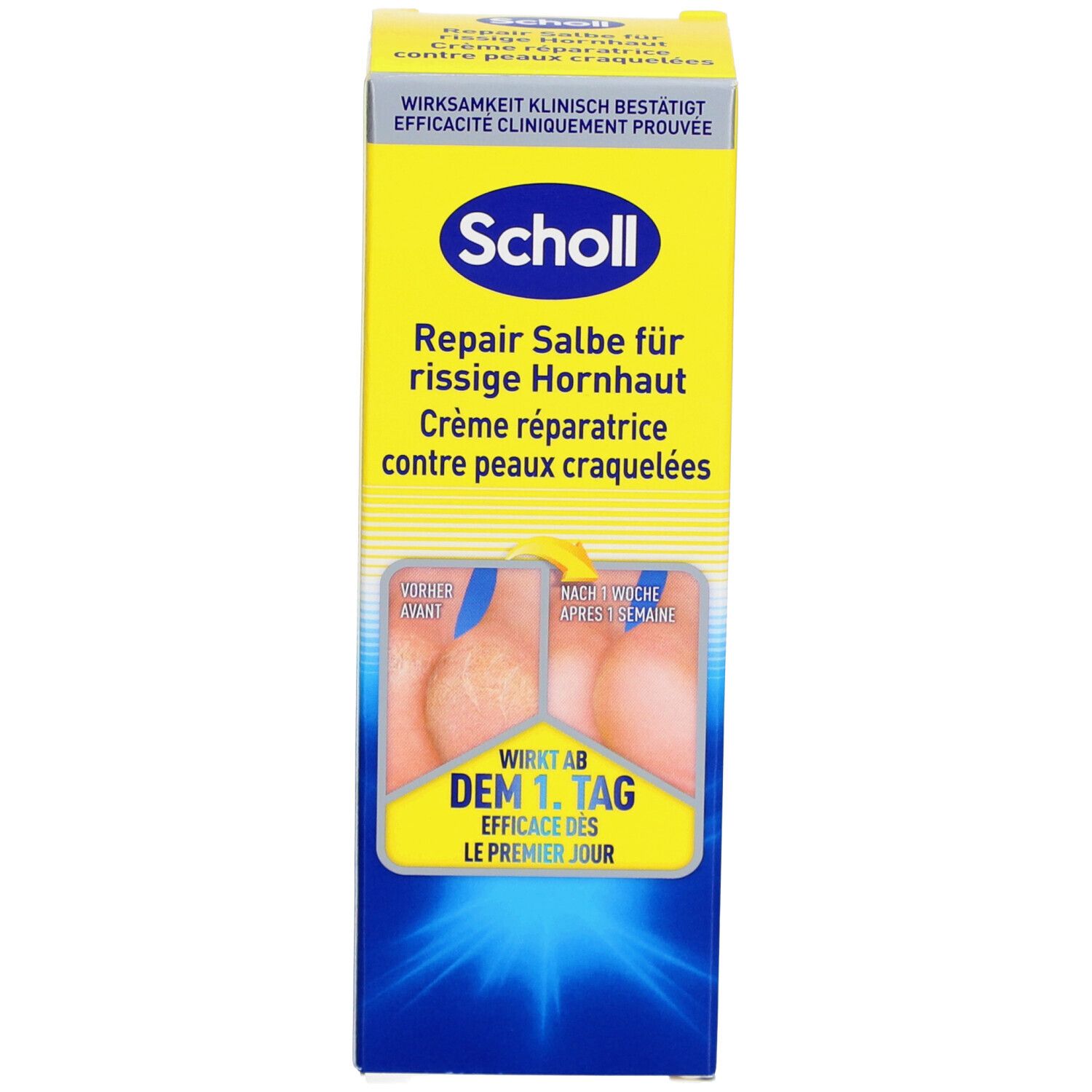 Kartonverpackung mit Produktinformationen. Zeigt Vorher-Nachher-Bilder von Füßen. Text: Wirkt ab dem 1. Tag.