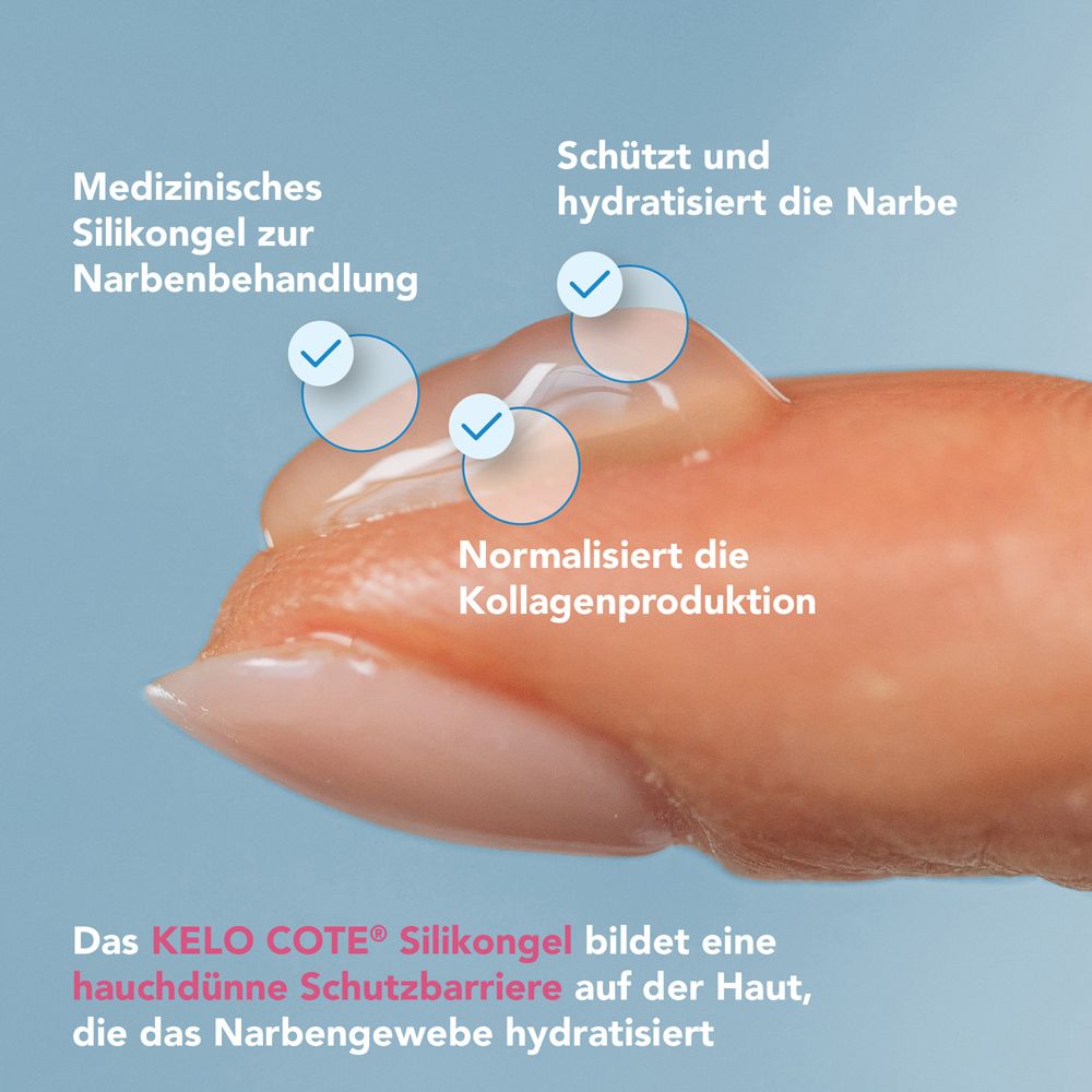 Nahaufnahme einer Hand mit Kelo-cote® Silikongel. Zeigt Schutzbarriere und Kollagenproduktion.