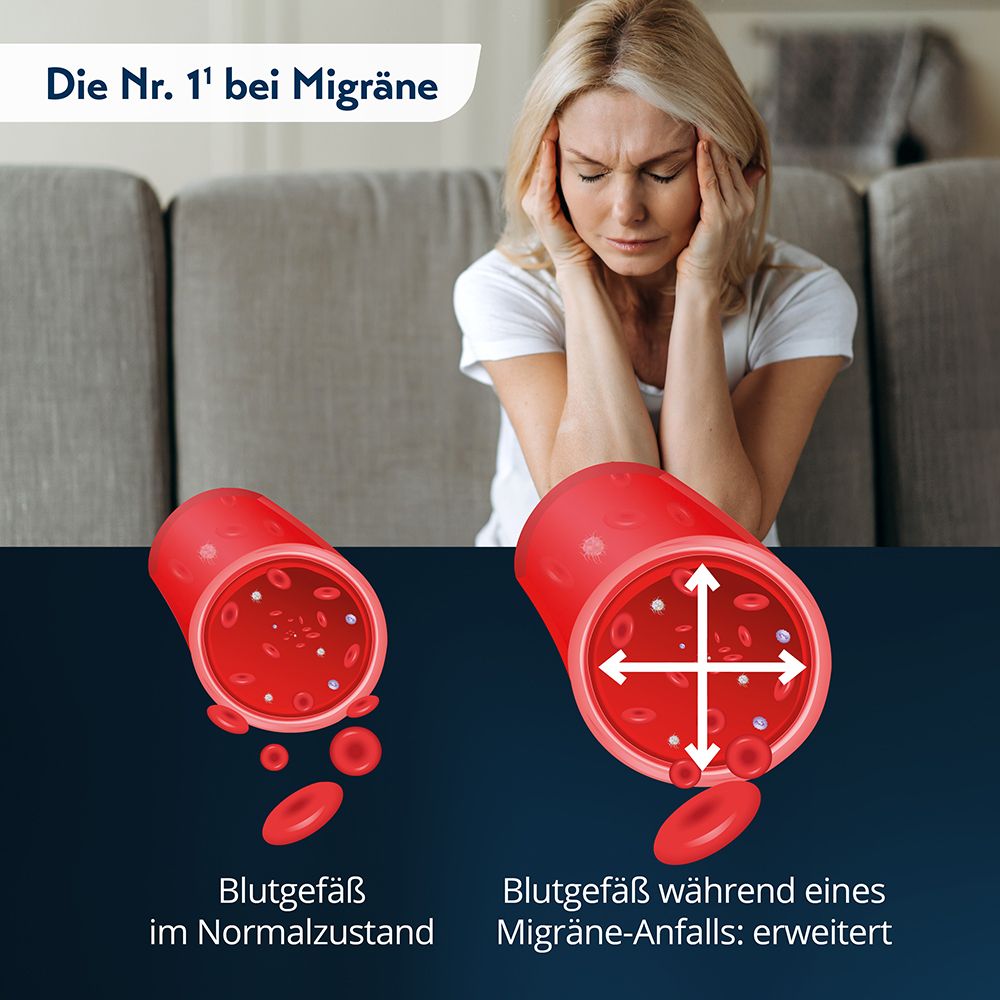 Vergleich: Blutgefäß im Normalzustand und erweitert während Migräneanfall.