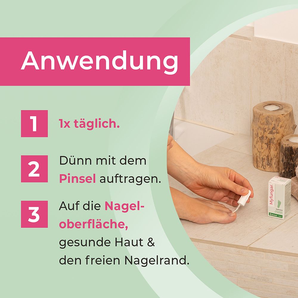 Anwendung von Myfungar: 1x täglich auf Nagel und Hautrand auftragen.