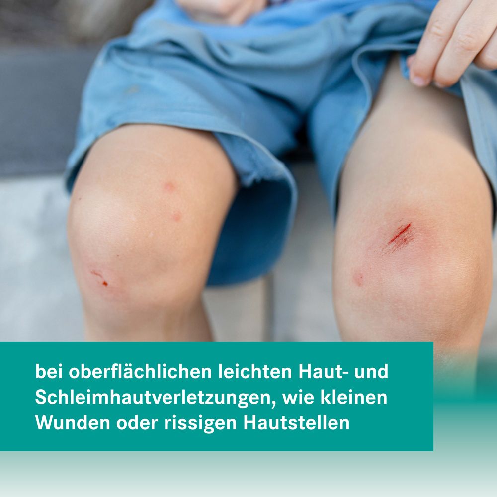 Beine mit kleinen Wunden. Text: bei oberflächlichen leichten Haut- und Schleimhautverletzungen, wie kleinen Wunden.