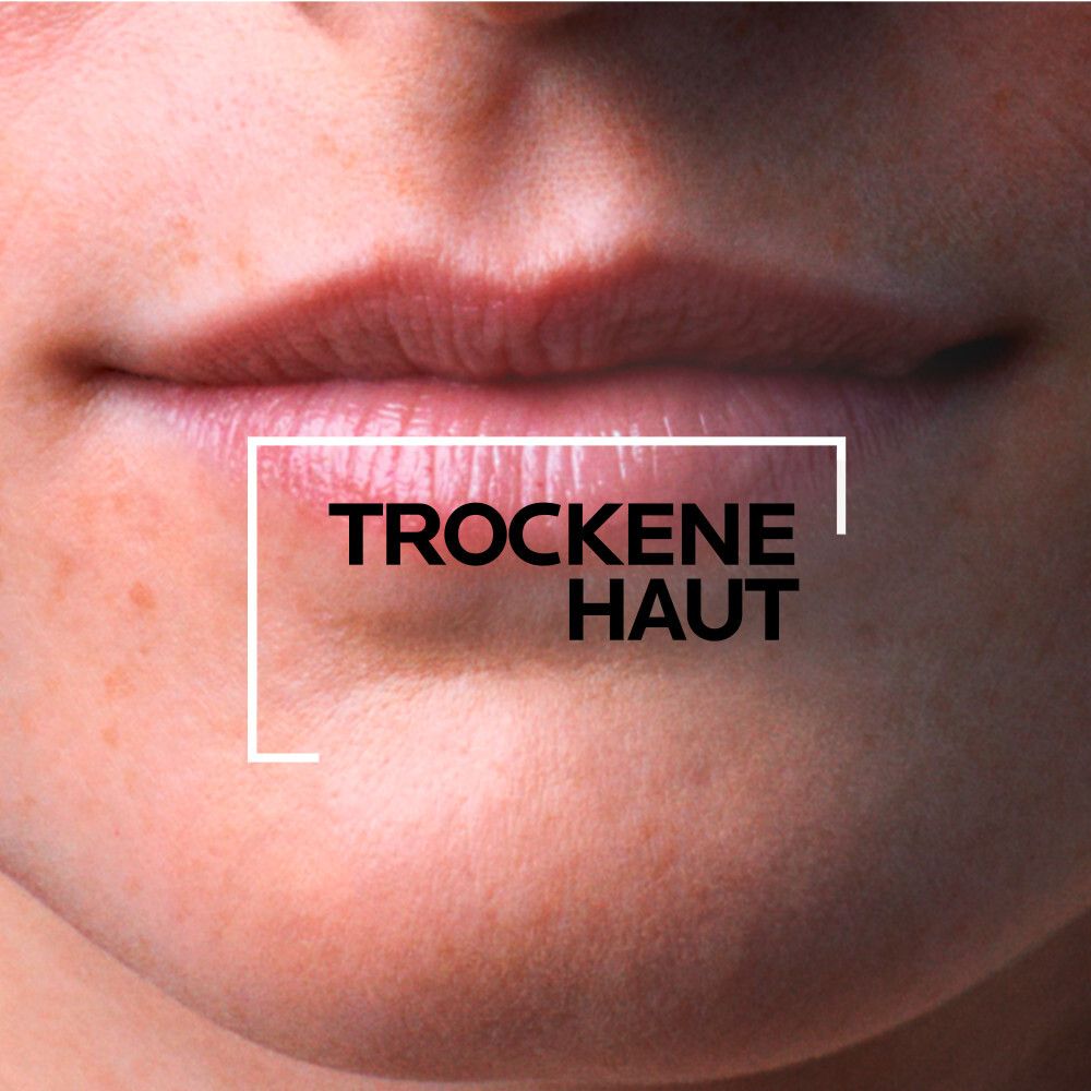 Nahaufnahme von Lippen. Text: Trockene Haut.