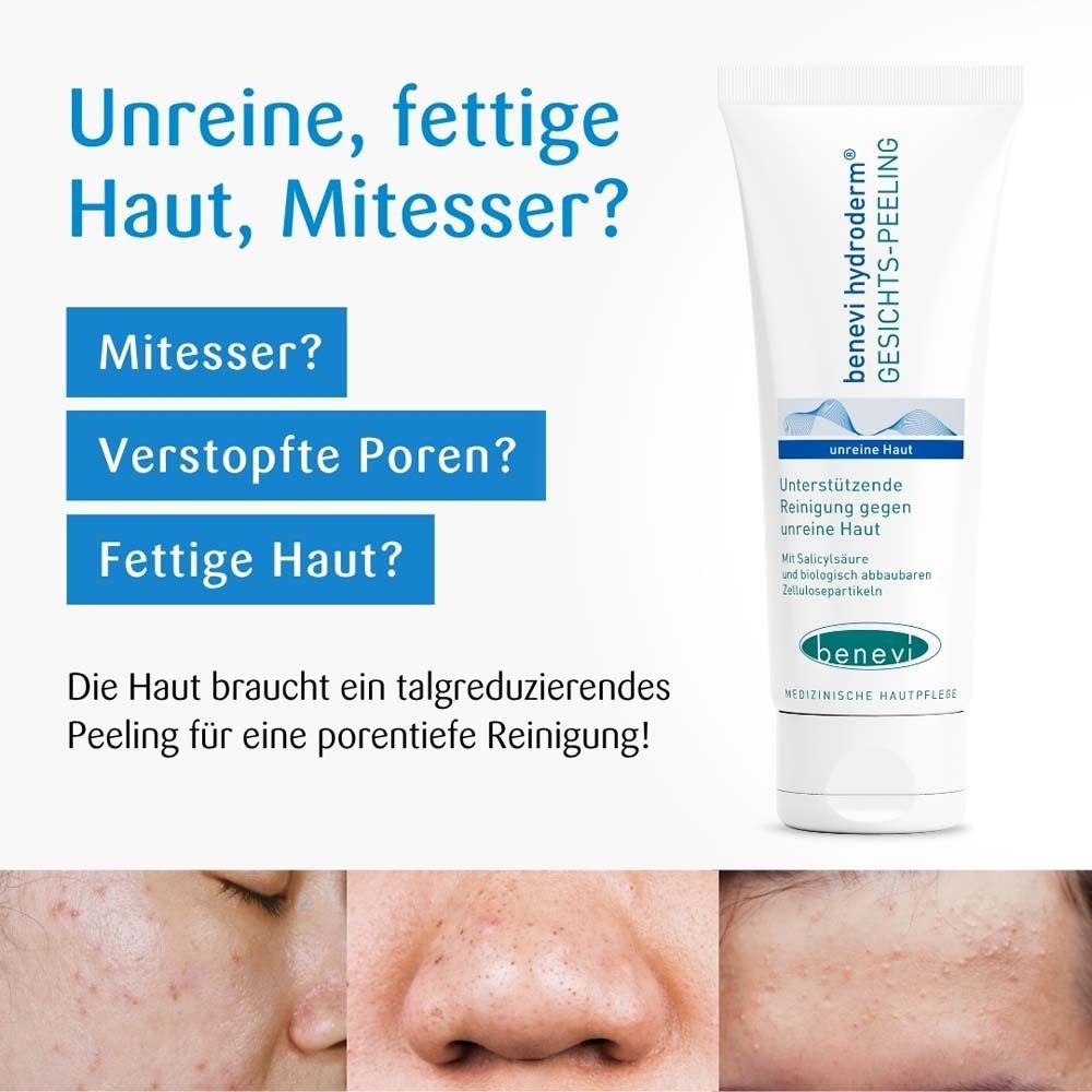 Produkt-Tube neben Text. Bilder von Hautunreinheiten. Text: Unreine, fettige Haut, Mitesser? Verstopfte Poren?