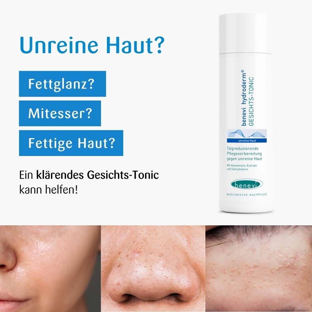 Gesichts-Tonic neben Bildern von unreiner Haut. Text: Unreine Haut? Fettglanz? Mitesser? benevi hydroderm.