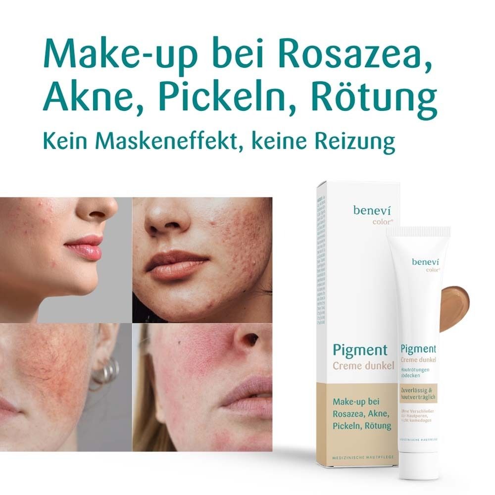 Pigmentcreme dunkel, Tube und Verpackung. Text: Make-up bei Rosacea, Akne, Pickeln, Rötung. Kein Maskeneffekt, keine Reizung.