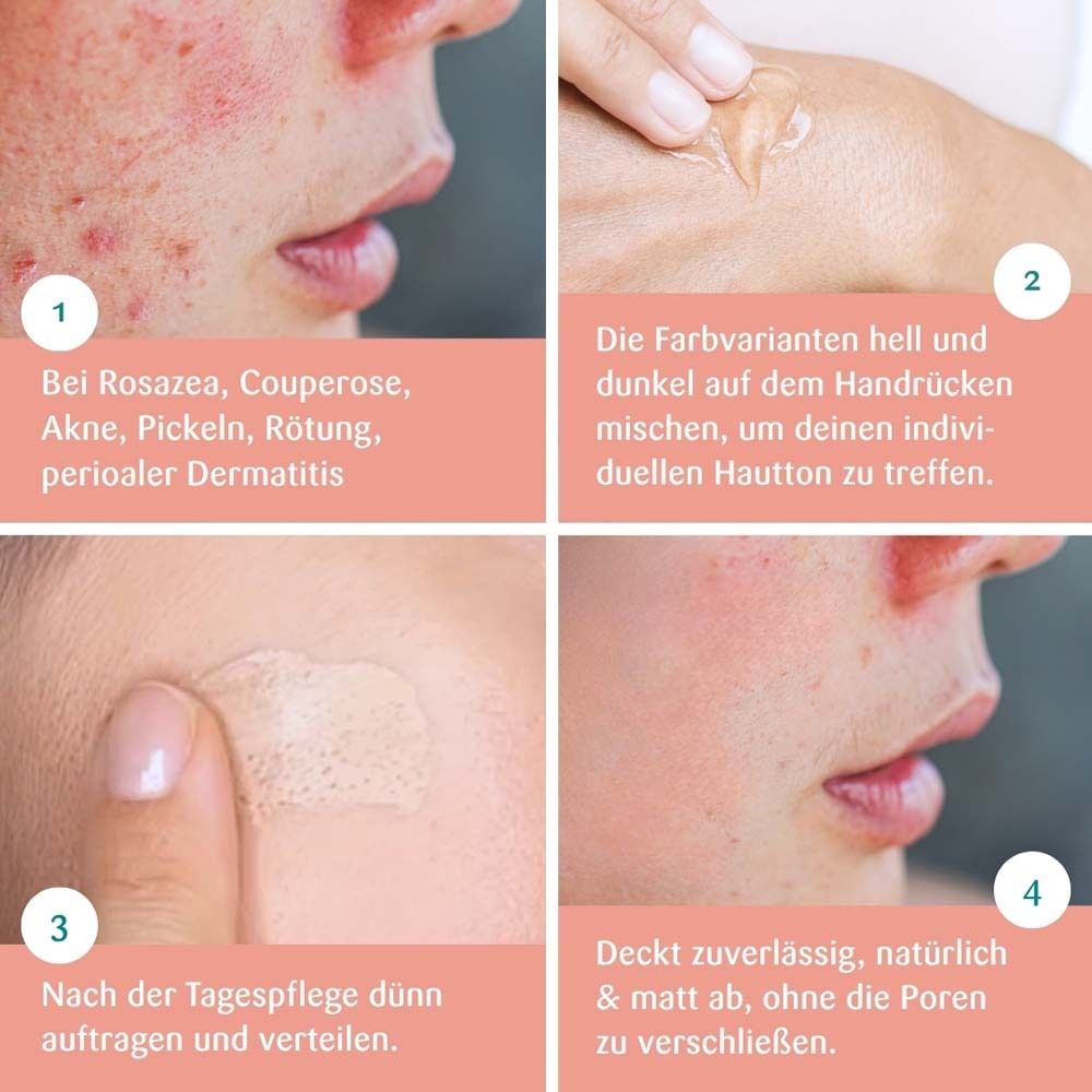 Vier Bilder zeigen Anwendung. Text: Bei Rosacea, Couperose, Akne, Pickeln, Rötung, perioraler Dermatitis. Deckt zuverlässig ab.