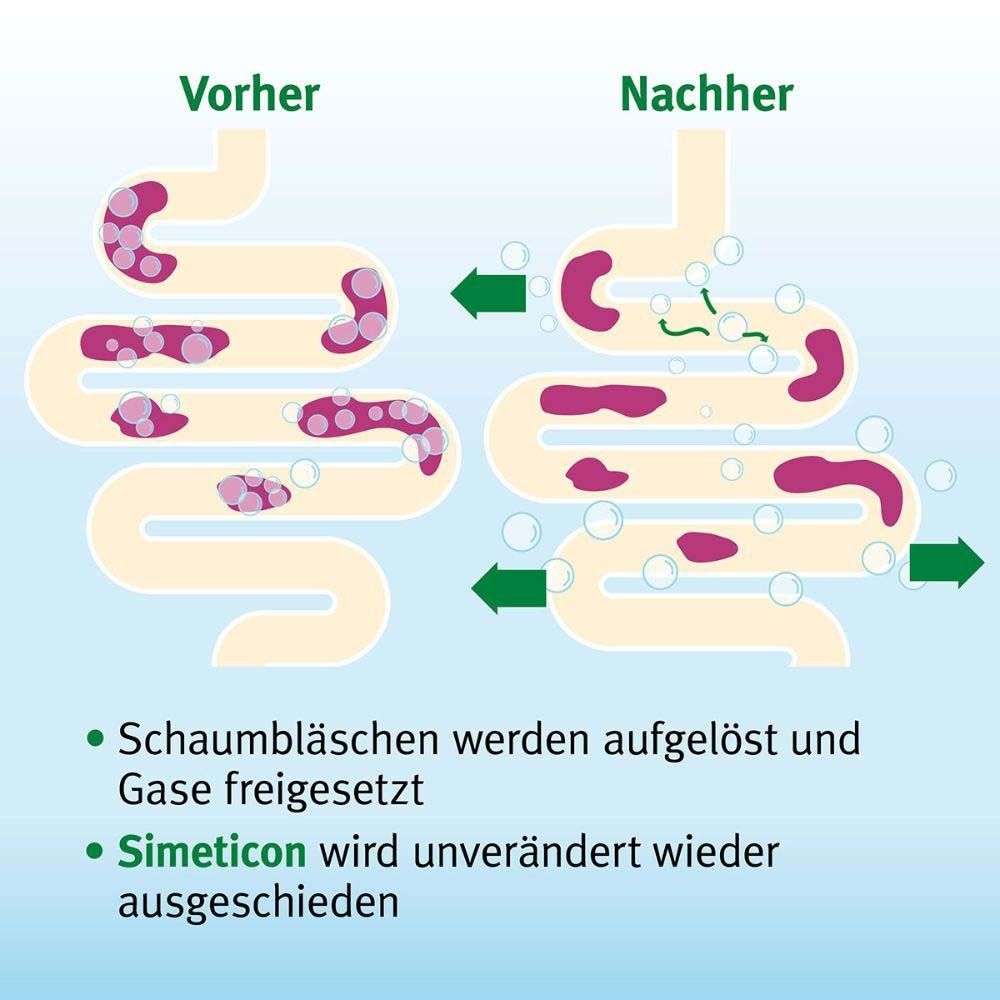 Espumisan® Kautabletten