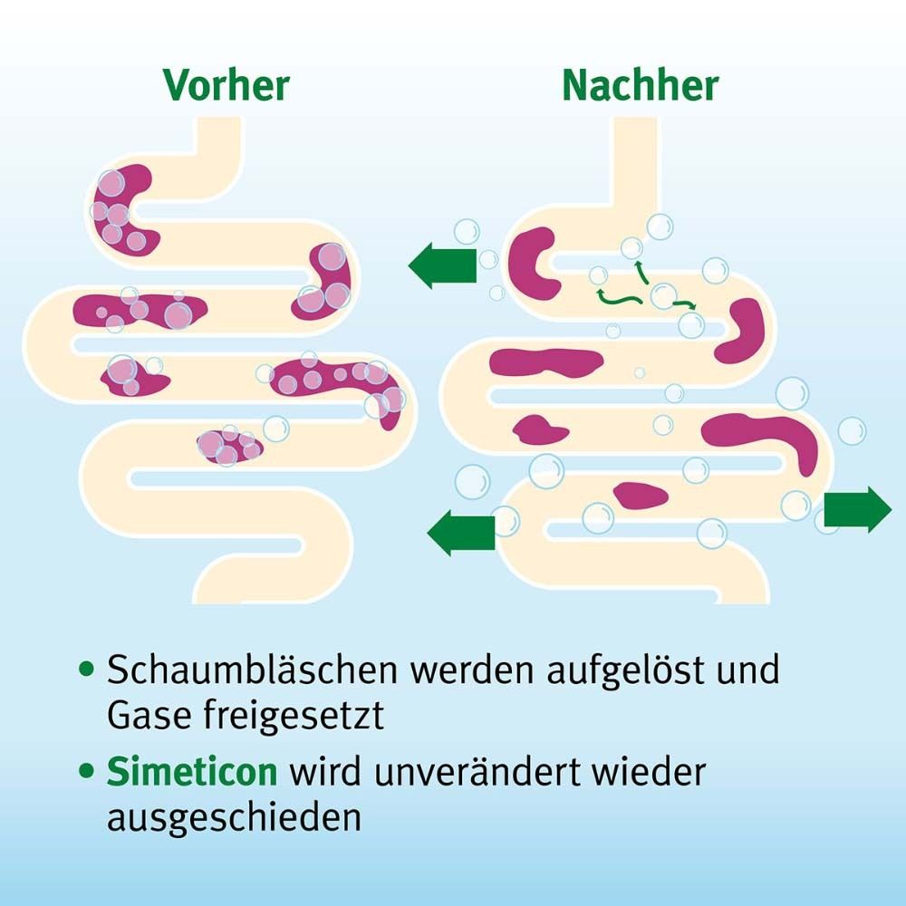 Vergleich Darm vor und nach Einnahme. Text: Schaumbläschen werden aufgelöst. Simeticon wird unverändert ausgeschieden.