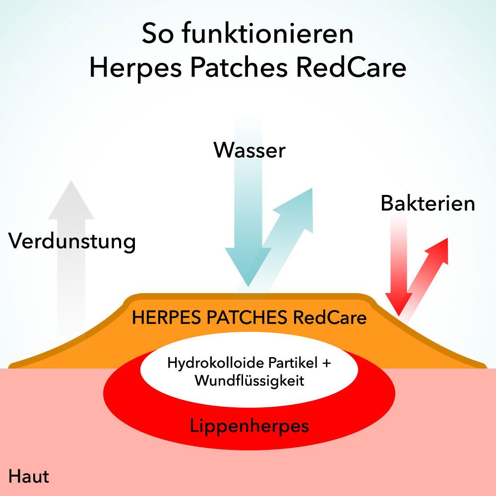 HERPES PATCHES RedCare Doppelpack