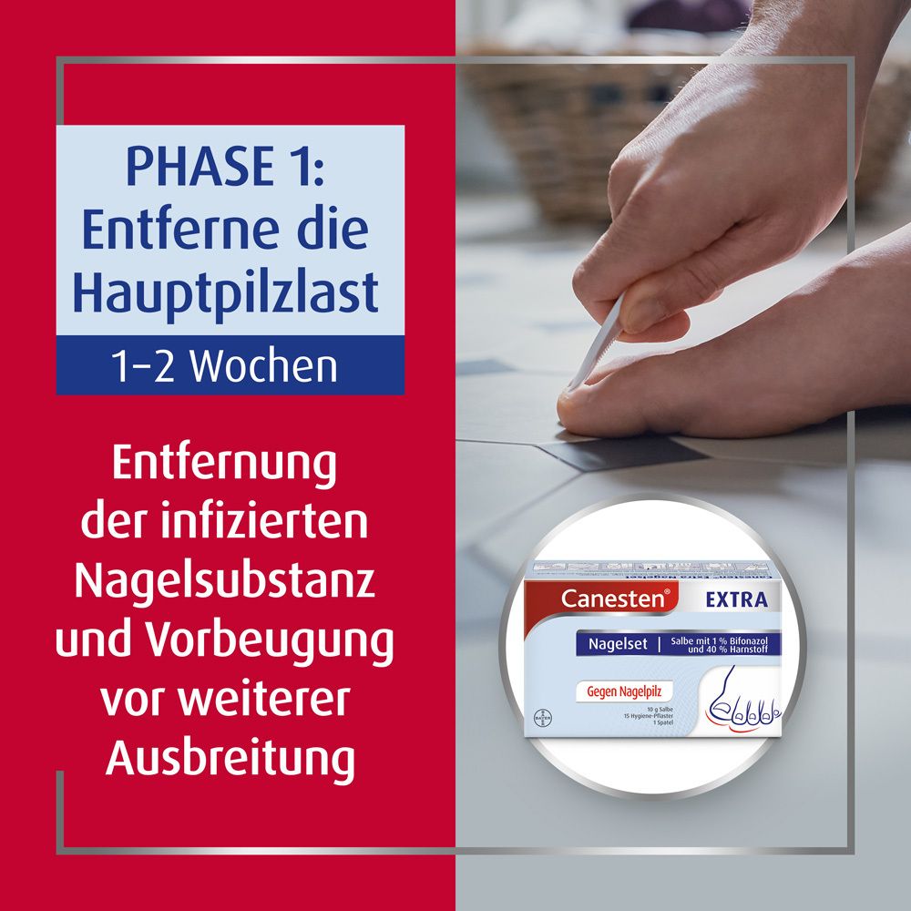 Hand entfernt Nagelteil. Canesten® EXTRA Nagelset. Text: Phase 1: Entferne die Hauptpilzlast. 1-2 Wochen.