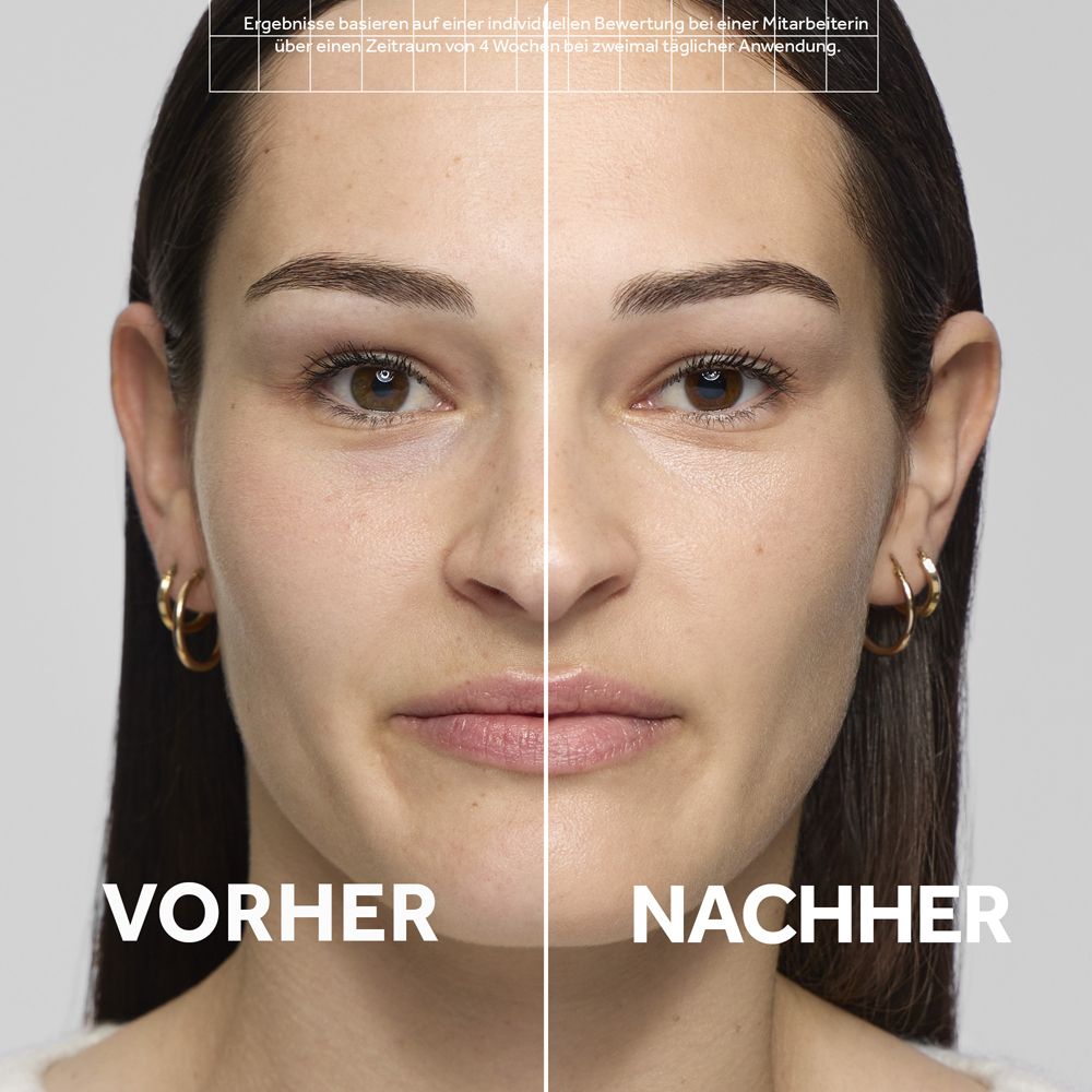 Vorher-Nachher-Vergleich einer Frau mit verbesserter Haut.