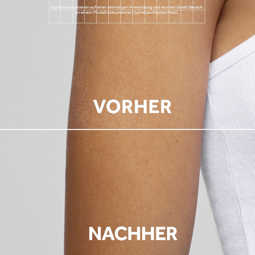 Vergleich von Haut vor und nach der Anwendung eines Produkts.