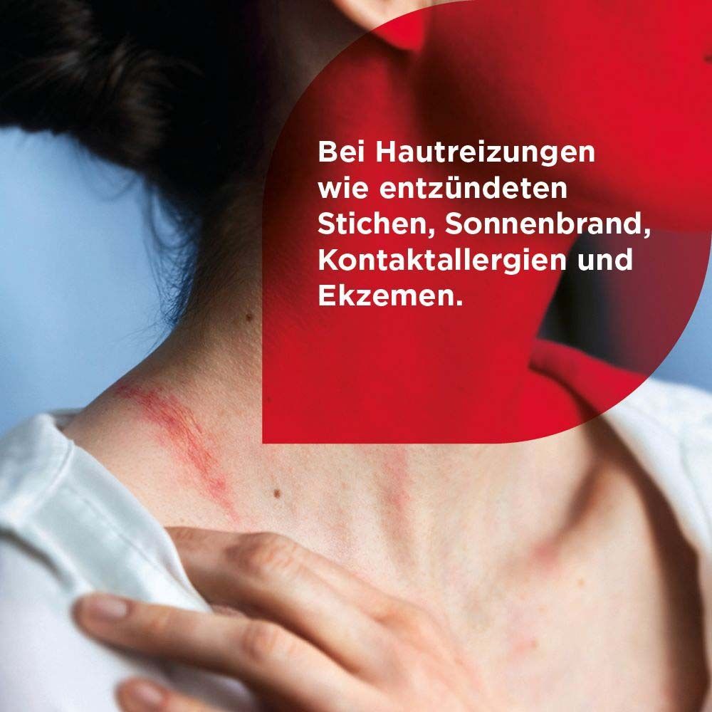 Hals mit Hautrötungen. Text: Bei Hautreizungen wie entzündeten Stichen, Sonnenbrand, Kontaktallergien und Ekzemen.