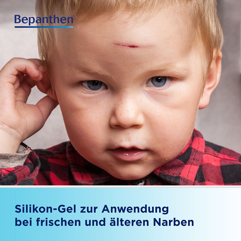 Kind mit frischer Narbe auf der Stirn. Text: Silikongel zur Anwendung bei frischen und älteren Narben.