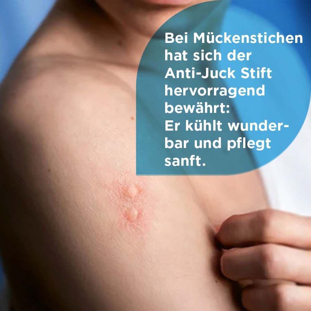 Haut mit Insektenstichen. Text: Bei Mückenstichen hat sich der Anti-Juck Stift hervorragend bewährt: Er kühlt wunderbar und pflegt sanft.