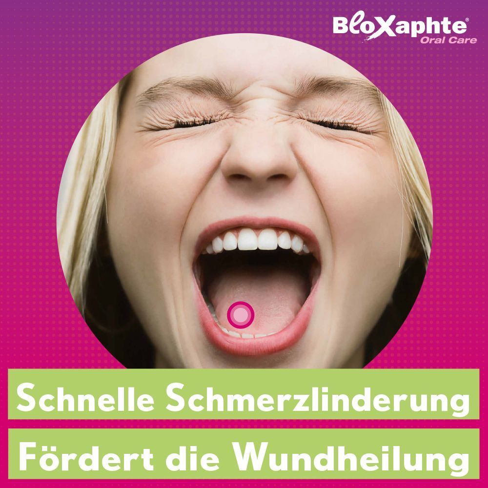 Frau schreit mit offenem Mund, ein roter Punkt zeigt auf eine Aphte.
