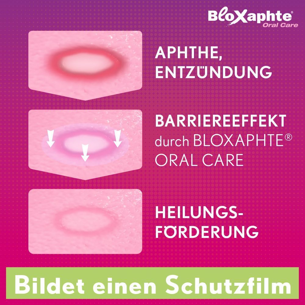 Schema zeigt Aphte, Barriereeffekt durch BloXaphte und Heilungsförderung.