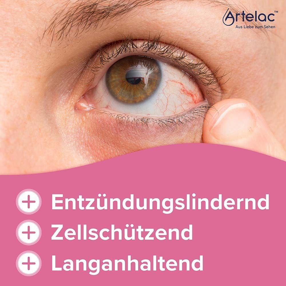 Nahaufnahme eines gereizten, roten Auges mit Finger.