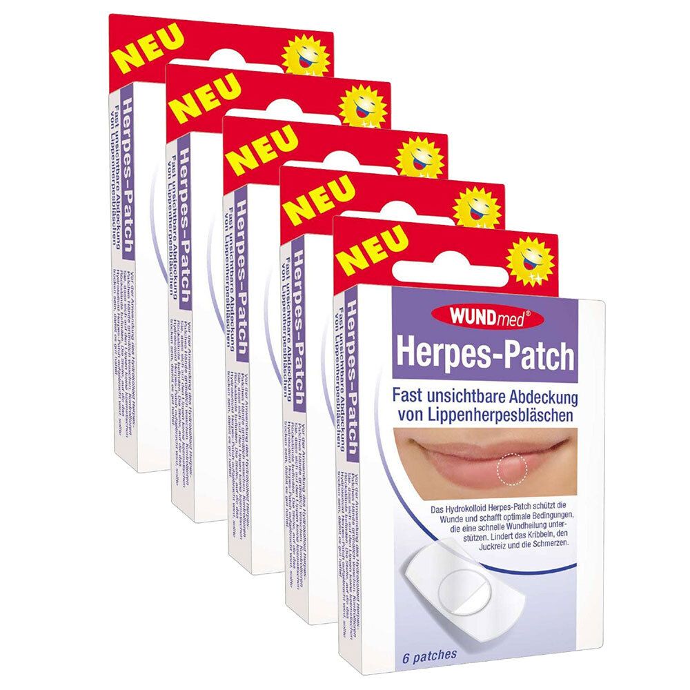 Mehrere Packungen Herpes-Patch. Aufdruck: WUNDmed, Herpes-Patch, 6 Patches. Auf rotem Banner: NEU. Gezeigt wird ein Lippenherpesbläschen.